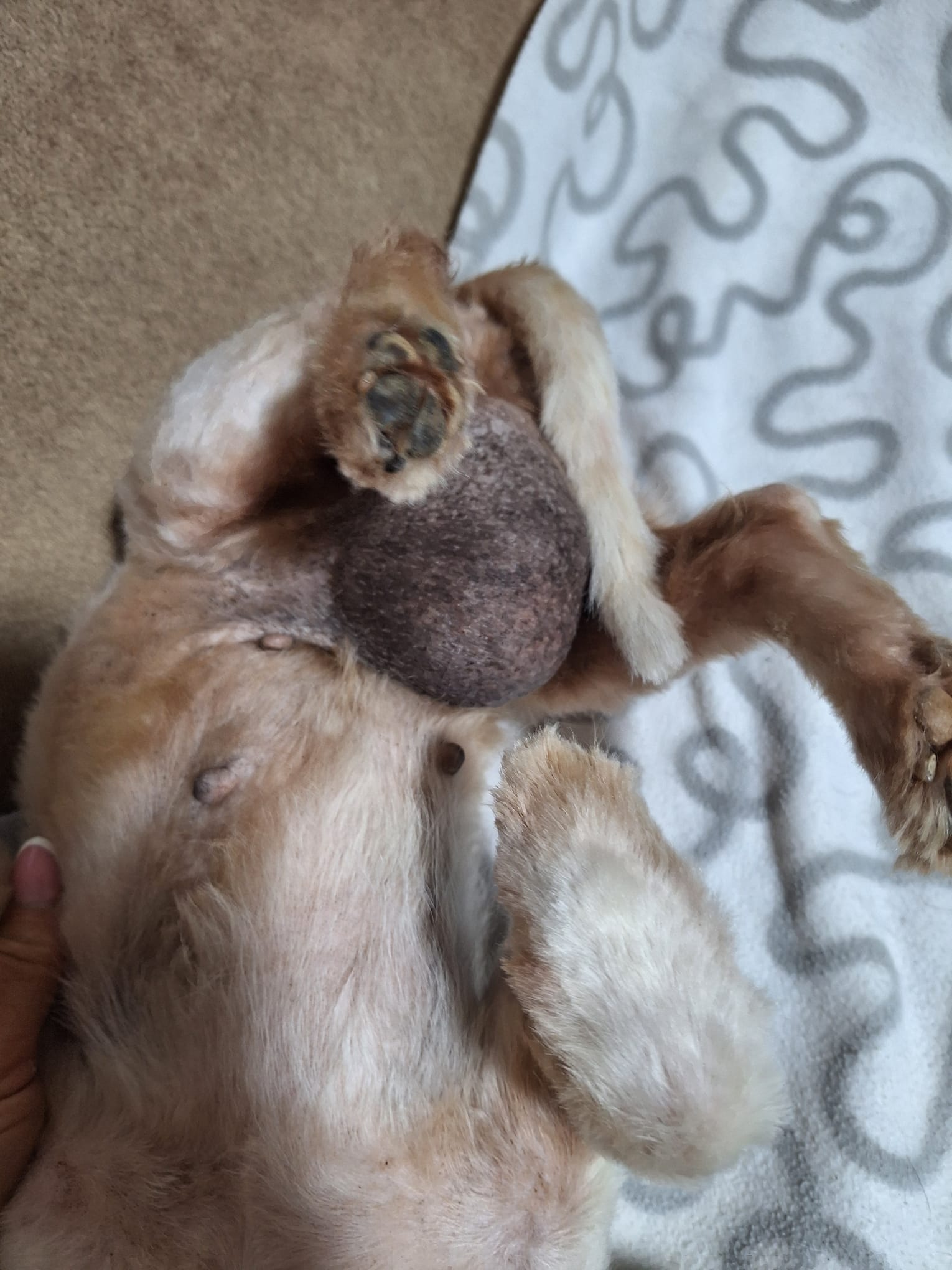 Ginis Tumor vor der Operation