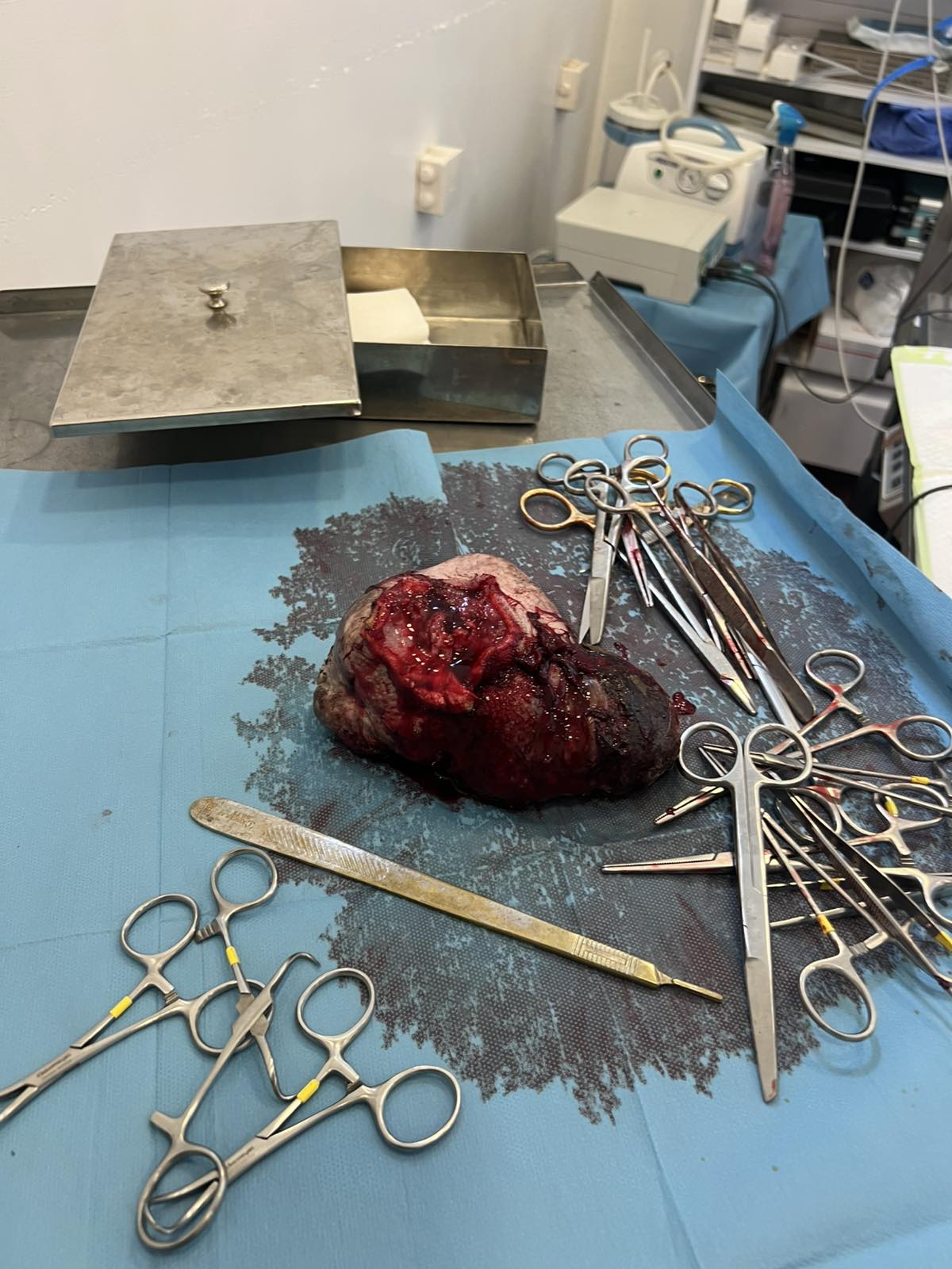 Der entfernte Tumor nach der Operation